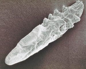 Nettoyage des Paupières et Lutte contre les Acariens Demodex : L’Efficacité de l’Huile d’Arbre à Thé