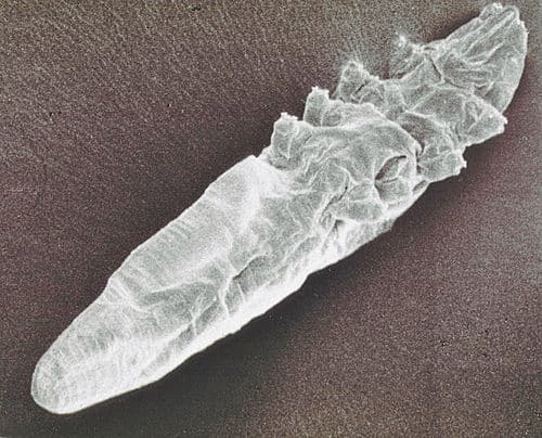 Nettoyage des Paupières et Lutte contre les Acariens Demodex : L’Efficacité de l’Huile d’Arbre à Thé